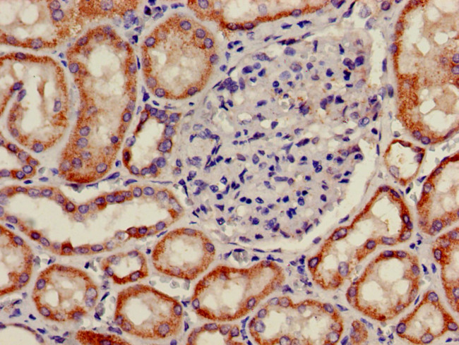 PNLIPRP2 Antibody in Immunohistochemistry (Paraffin) (IHC (P))