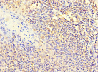 POLB Antibody in Immunohistochemistry (Paraffin) (IHC (P))