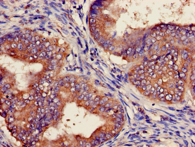 POLH Antibody in Immunohistochemistry (Paraffin) (IHC (P))