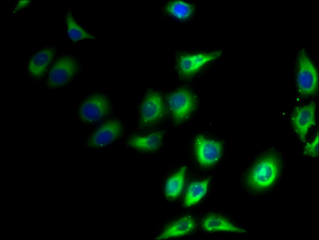 PPAP2C Antibody in Immunocytochemistry (ICC/IF)