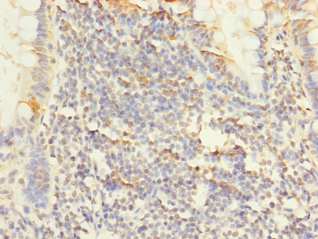 PPAP2C Antibody in Immunohistochemistry (Paraffin) (IHC (P))