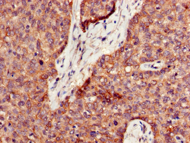 PPT1 Antibody in Immunohistochemistry (Paraffin) (IHC (P))