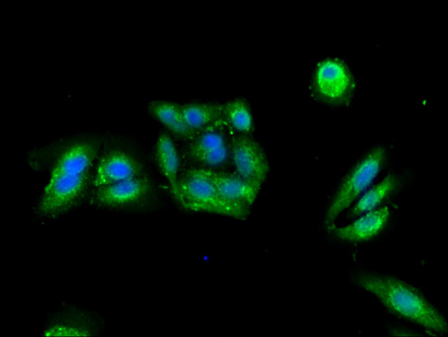 PRKAR2A Antibody in Immunocytochemistry (ICC/IF)