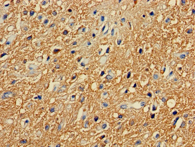 PRKAR2A Antibody in Immunohistochemistry (Paraffin) (IHC (P))