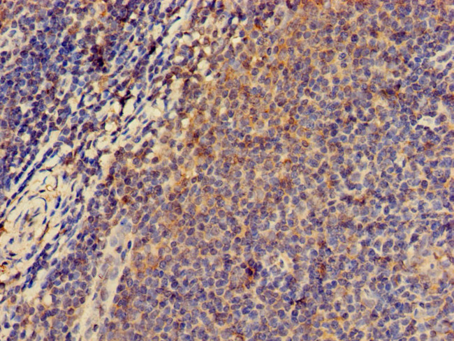 PRKAR2A Antibody in Immunohistochemistry (Paraffin) (IHC (P))