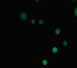 PRMT3 Antibody in Immunocytochemistry (ICC/IF)