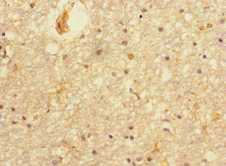 PRMT3 Antibody in Immunohistochemistry (Paraffin) (IHC (P))