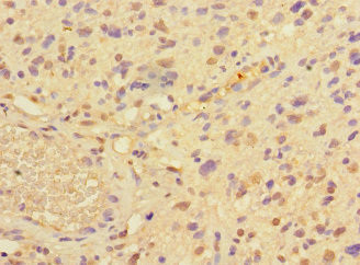 PRMT3 Antibody in Immunohistochemistry (Paraffin) (IHC (P))