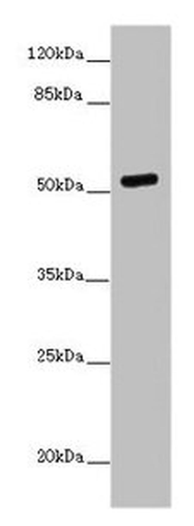 PRMT3 Antibody in Western Blot (WB)