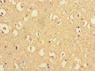 Presenilin 1 Antibody in Immunohistochemistry (Paraffin) (IHC (P))