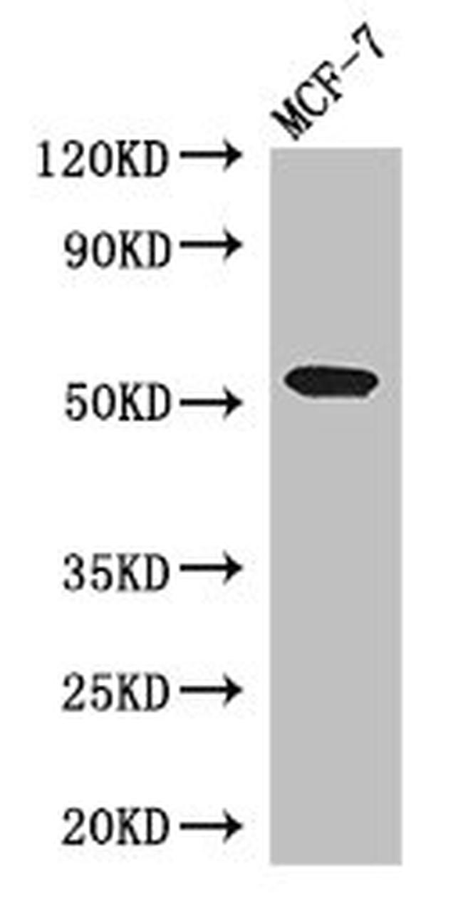 Presenilin 1 Antibody in Western Blot (WB)