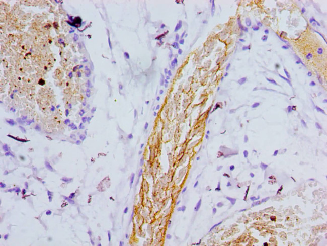 Presenilin 1 Antibody in Immunohistochemistry (Paraffin) (IHC (P))