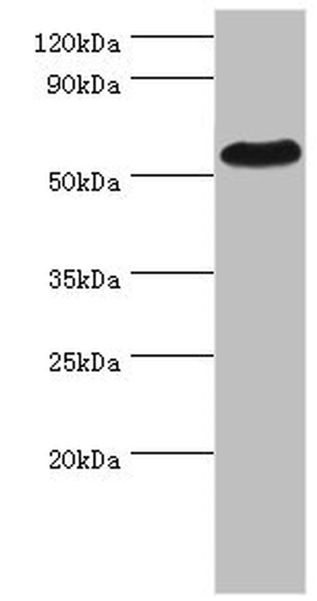 Presenilin 1 Antibody in Western Blot (WB)