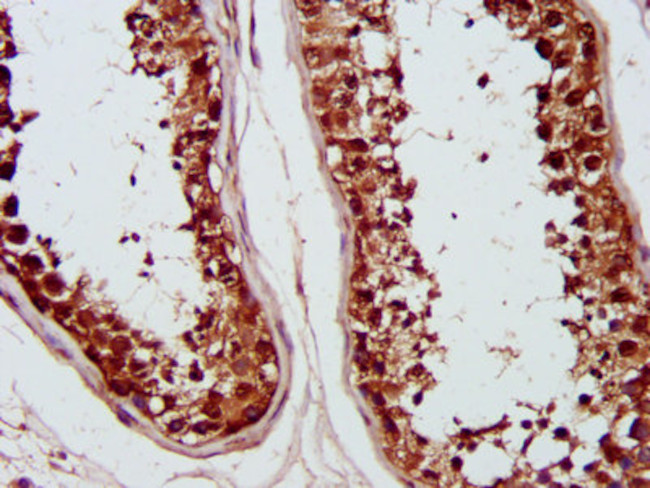 PSMC6 Antibody in Immunohistochemistry (Paraffin) (IHC (P))