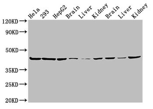 PSMC6 Antibody in Western Blot (WB)