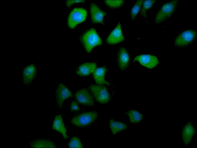 PTGR2 Antibody in Immunocytochemistry (ICC/IF)