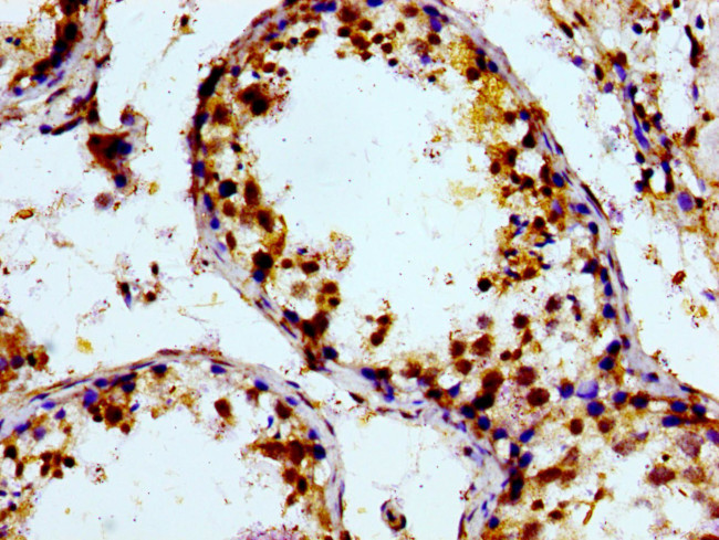 PTGR2 Antibody in Immunohistochemistry (Paraffin) (IHC (P))