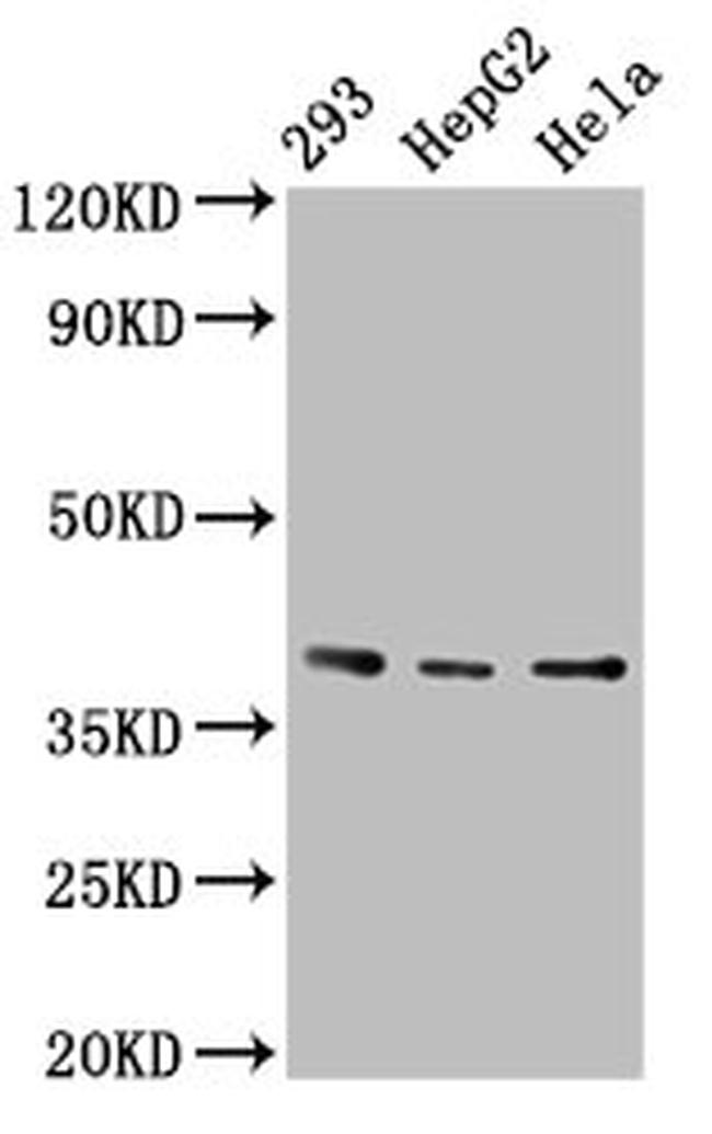 PTGR2 Antibody in Western Blot (WB)