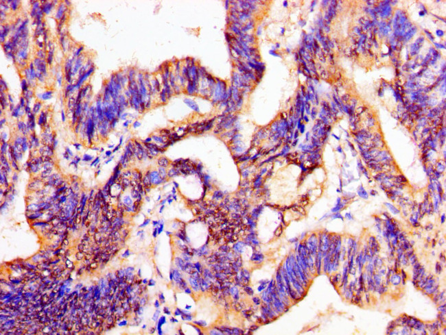 PTX3 Antibody in Immunohistochemistry (Paraffin) (IHC (P))