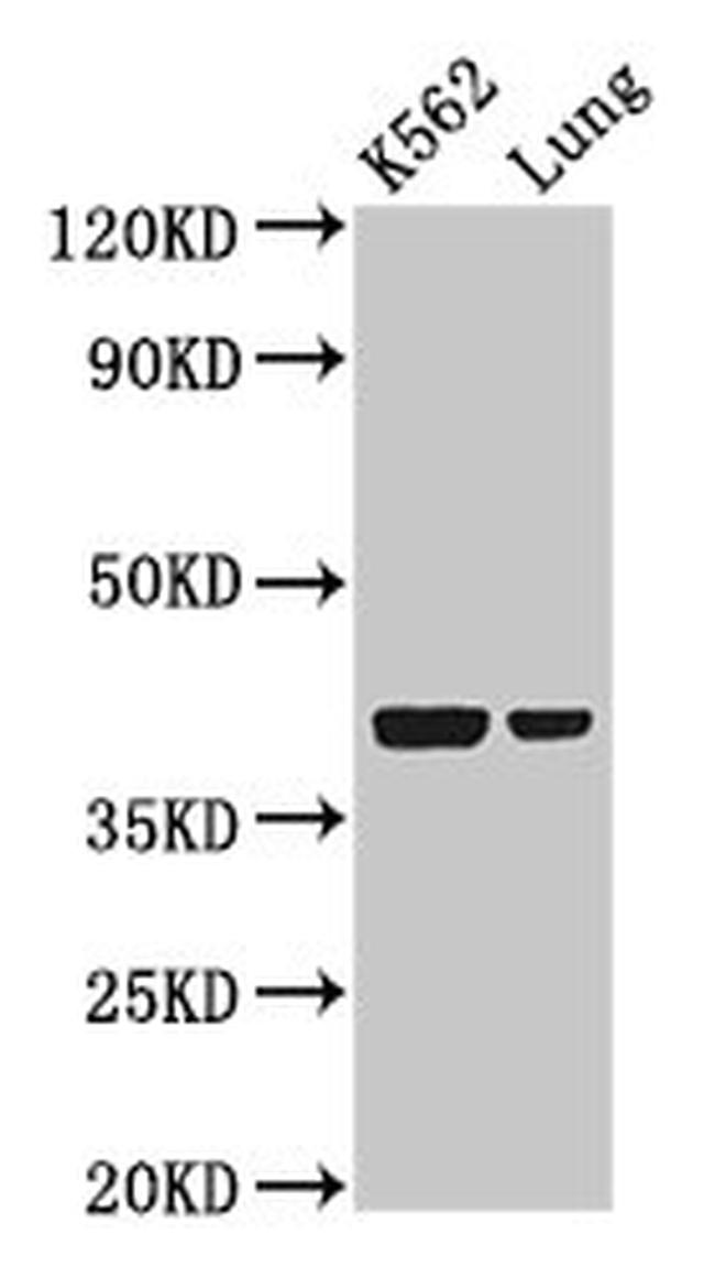 PTX3 Antibody in Western Blot (WB)