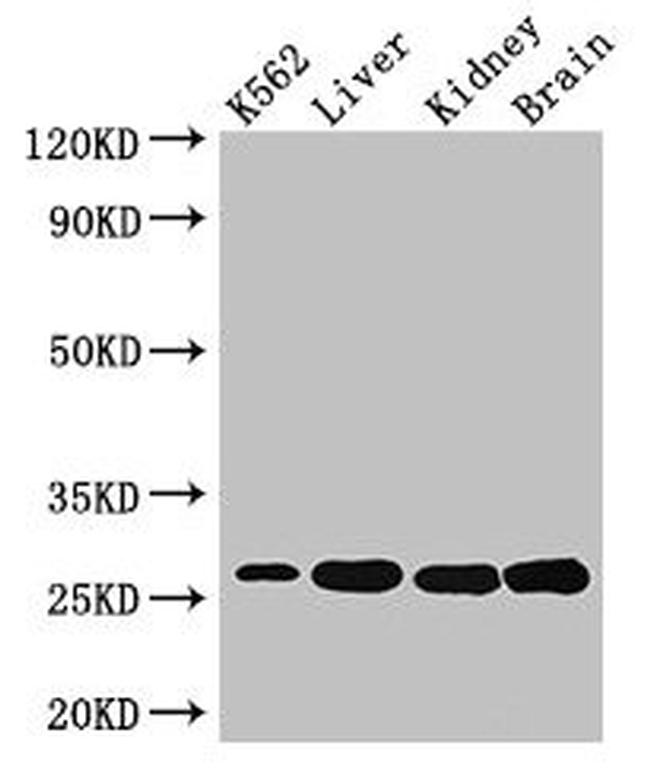 QDPR Antibody in Western Blot (WB)