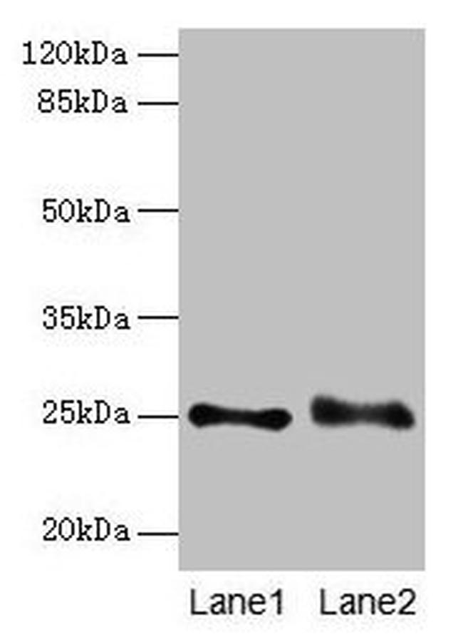 RAB3B Antibody in Western Blot (WB)