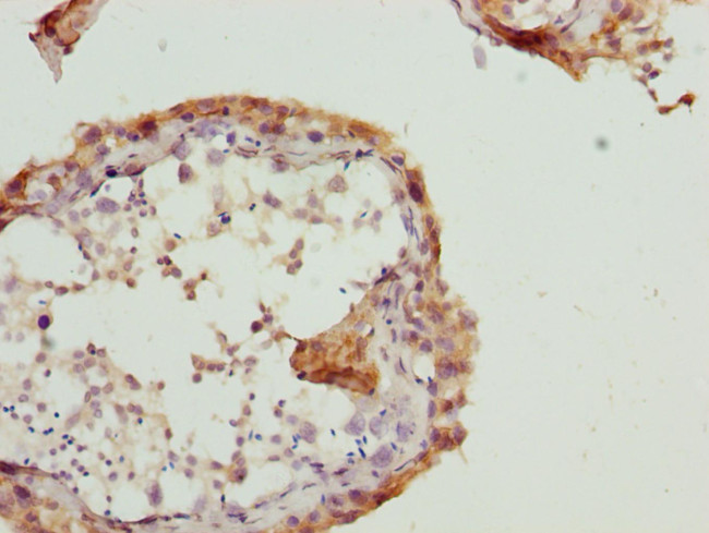 RAB5B Antibody in Immunohistochemistry (Paraffin) (IHC (P))