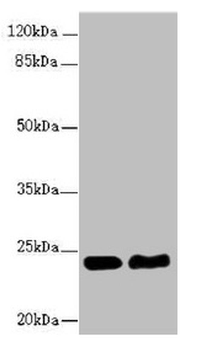 RAB5B Antibody in Western Blot (WB)