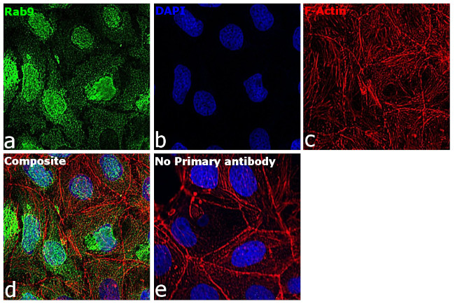 RAB9 Antibody in Immunocytochemistry (ICC/IF)