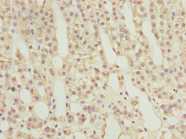 RAB9 Antibody in Immunohistochemistry (Paraffin) (IHC (P))