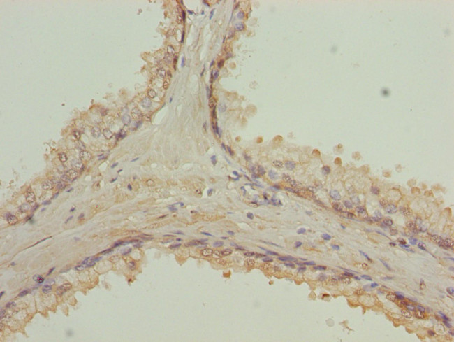 RAB9 Antibody in Immunohistochemistry (Paraffin) (IHC (P))