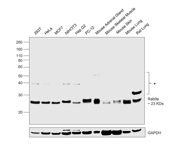 RAB9 Antibody in Western Blot (WB)