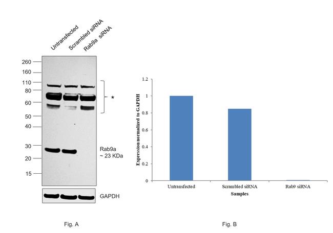 RAB9 Antibody in Western Blot (WB)