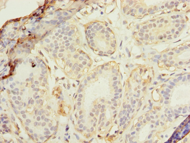 RAD23B Antibody in Immunohistochemistry (Paraffin) (IHC (P))