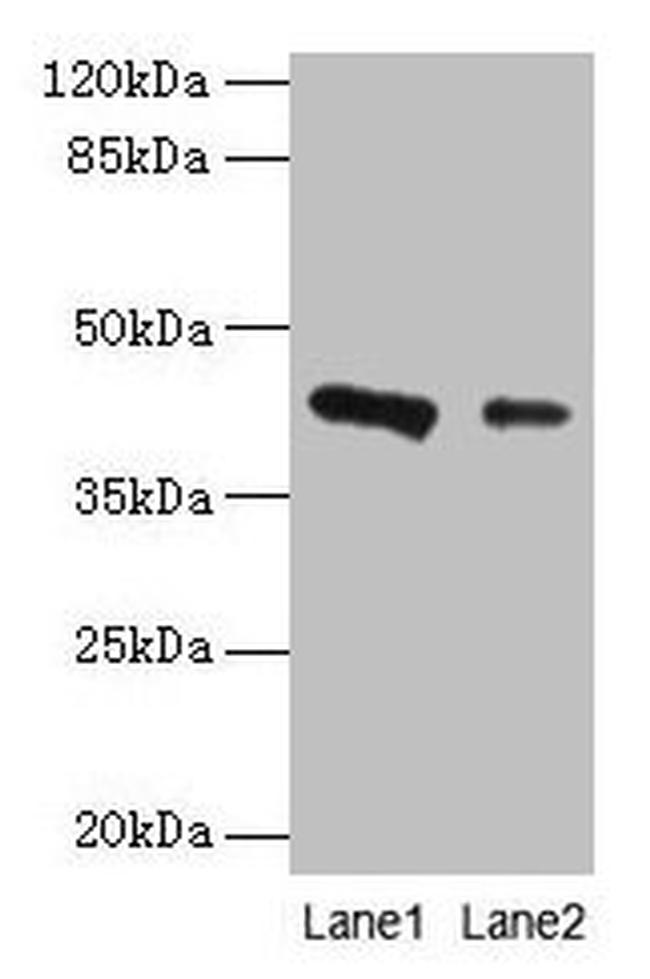 RAD23B Antibody in Western Blot (WB)