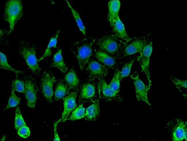 RARS Antibody in Immunocytochemistry (ICC/IF)