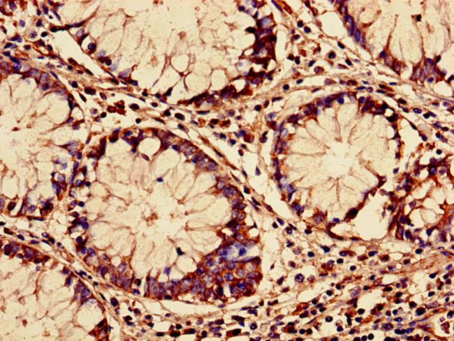 RARS Antibody in Immunohistochemistry (Paraffin) (IHC (P))