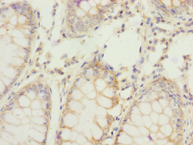 REC8 Antibody in Immunohistochemistry (Paraffin) (IHC (P))