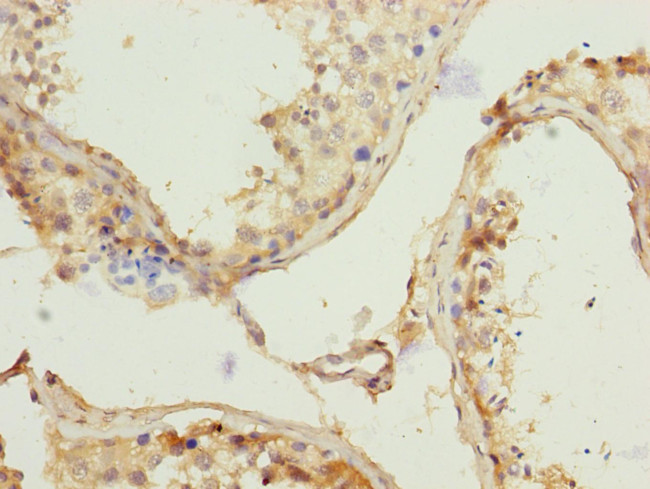 REC8 Antibody in Immunohistochemistry (Paraffin) (IHC (P))