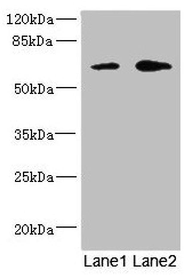 REC8 Antibody in Western Blot (WB)