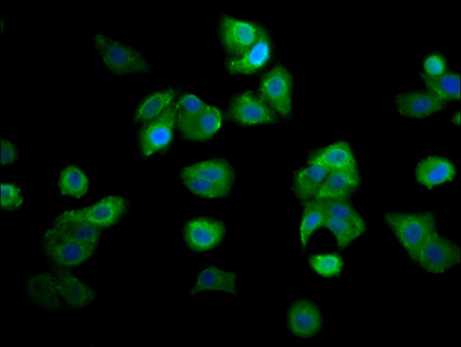 RECQ4 Antibody in Immunocytochemistry (ICC/IF)