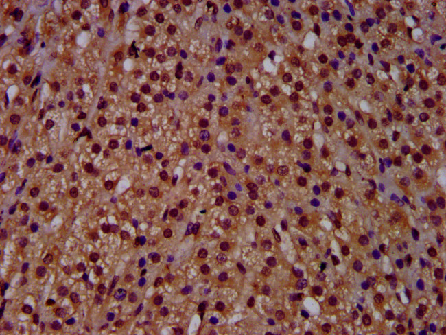 RECQ4 Antibody in Immunohistochemistry (Paraffin) (IHC (P))