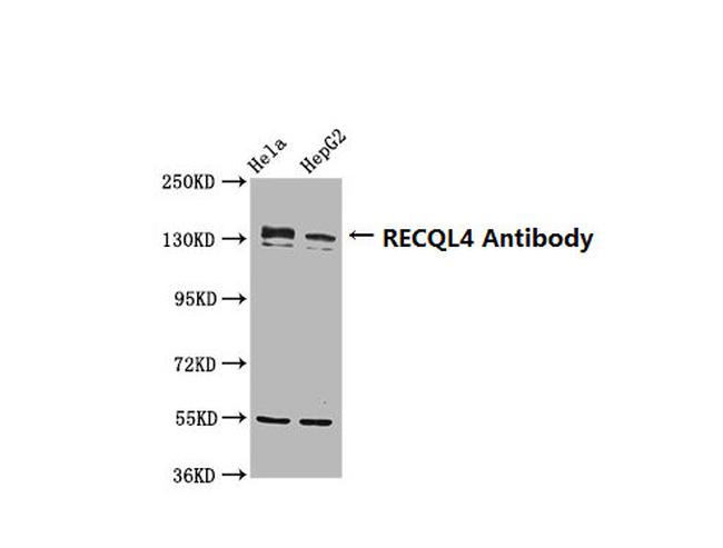 RECQ4 Antibody in Western Blot (WB)