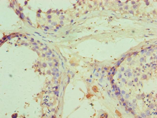 RNF8 Antibody in Immunohistochemistry (Paraffin) (IHC (P))