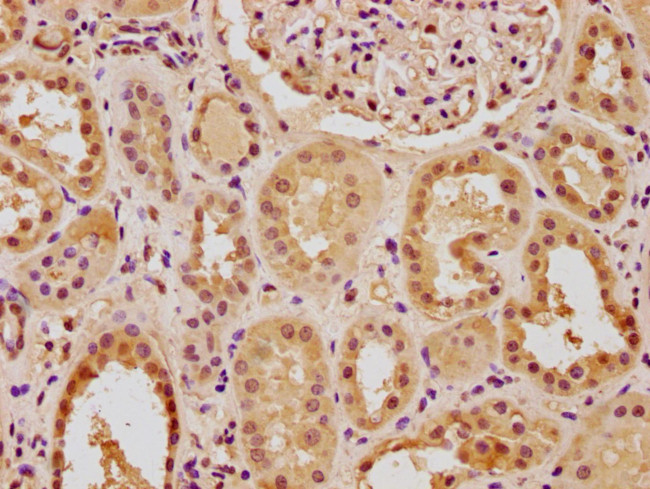 PTBP3 Antibody in Immunohistochemistry (Paraffin) (IHC (P))