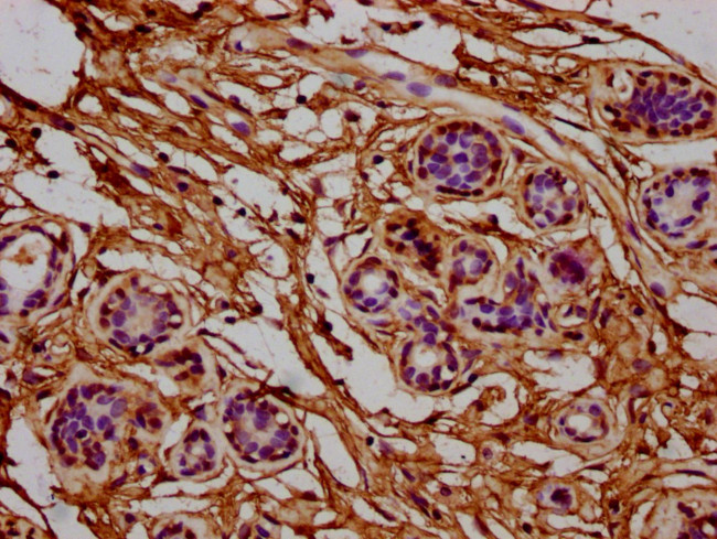 RPL7A Antibody in Immunohistochemistry (Paraffin) (IHC (P))