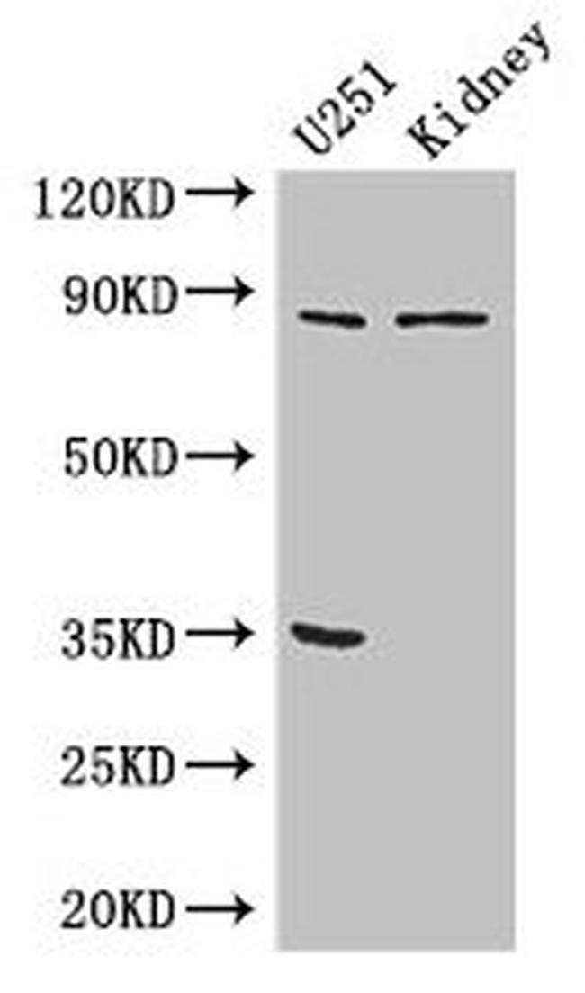 MSK2 Antibody in Western Blot (WB)