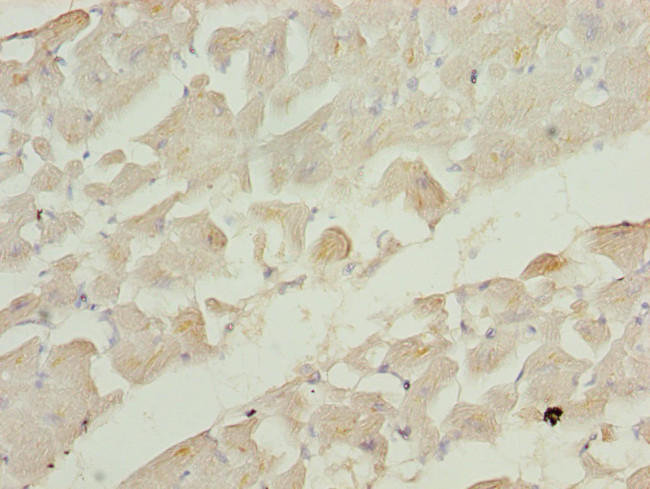 RRAS2 Antibody in Immunohistochemistry (Paraffin) (IHC (P))