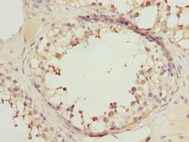 RRAS2 Antibody in Immunohistochemistry (Paraffin) (IHC (P))