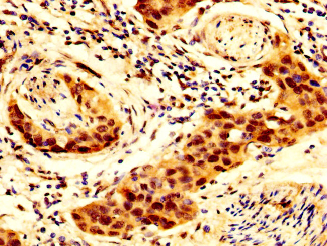 SCNN1B Antibody in Immunohistochemistry (Paraffin) (IHC (P))